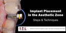 https://dentalmp4.com/wp-content/uploads/2023/06/Implant-Placement-in-the-Aesthetic-Zone-Steps-Techniques.jpg
