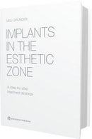 https://www.dentalbooks.org/wp-content/uploads/2019/02/Implants-In-The-Esthetic-Zone-A-Step-By-Step-Treatment-Strategy.jpg