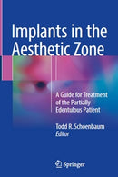 https://www.dentalbooks.org/wp-content/uploads/2019/02/Implants-in-the-Aesthetic-Zone.jpg
