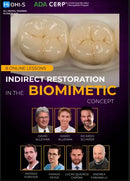 https://dentalmp4.com/wp-content/uploads/2024/04/Indirect-Restoration-in-the-Biomimetic-Concept.webp