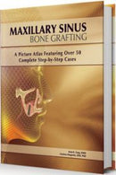 https://www.dentalbooks.org/wp-content/uploads/2020/04/Maxillary-Sinus-Bone-Grafting-A-Picture-Atlas-Featuring-over-50-Complete-Step-By-Step-Cases-180x270.jpg