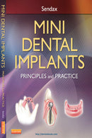 https://www.dentalbooks.org/wp-content/uploads/2019/02/Mini-Dental-Implants-Principles-and-Practice.jpg