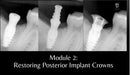 https://dentalmp4.com/wp-content/uploads/2023/11/Module-2.jpg