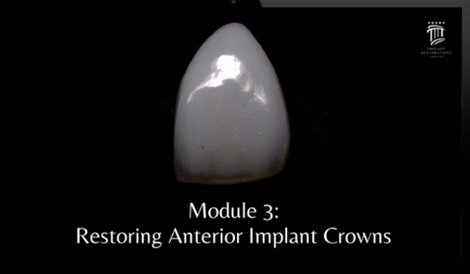 Implant Restorations Simplified: Restore Dental Implants with Accuracy &amp; Confidence (Surgical Master) - Dentistry eBooks