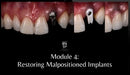 https://dentalmp4.com/wp-content/uploads/2023/11/Module-4.jpg