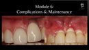 https://dentalmp4.com/wp-content/uploads/2023/11/Module-6.jpg