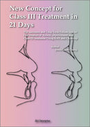 New concept for Class III treatment in 21 days