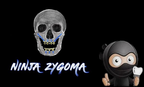 Ninja Zygoma Course - Dentistry eBooks
