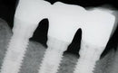 https://dentalmp4.com/wp-content/uploads/2022/06/Online-Residency-Program-A-Z-in-Implant-Dentistry.jpg