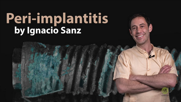 https://dentalmp4.com/wp-content/uploads/2022/12/Peri-Implantitis_Ignacio-Sanz.jpg