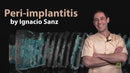 https://dentalmp4.com/wp-content/uploads/2022/12/Peri-Implantitis_Ignacio-Sanz.jpg