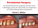 https://dental-books.com/wp-content/uploads/2023/04/Periodontal-Surgery_A-Comprehensive-Surgical-Course.jpg
