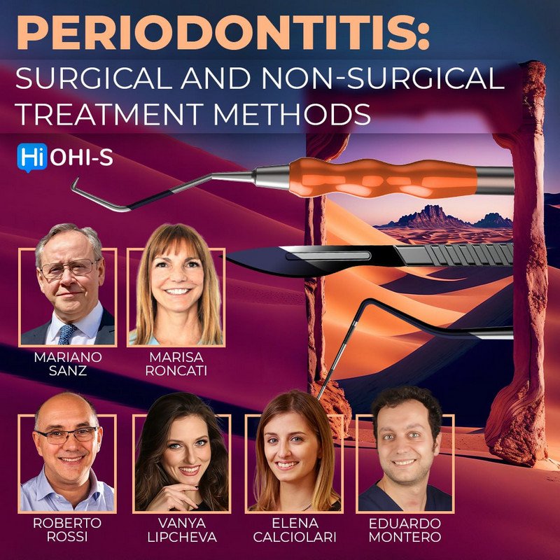 Periodontitis - Surgical and Non-Surgical Treatment Methods - Dentistry eBooks