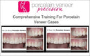 https://dentalmp4.com/wp-content/uploads/2023/08/Porcelain-Veneer-Precision-Comprehensive-Training-for-Porcelain-Veneer-Cases.jpg