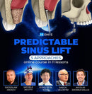 https://dentalmp4.com/wp-content/uploads/2024/04/Predictable-sinus-lift.jpg