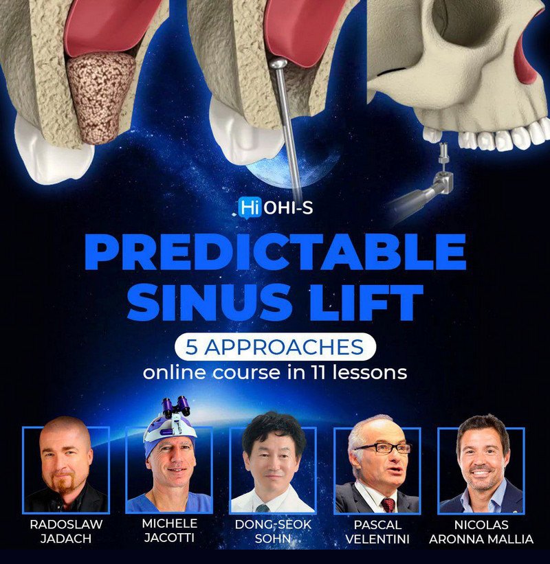 Predictable Sinus Lift Course - Dentistry eBooks