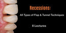 https://dental-books.com/wp-content/uploads/2022/12/Recessions-All-Types-of-Flap-Tunnel-Techniques.jpg