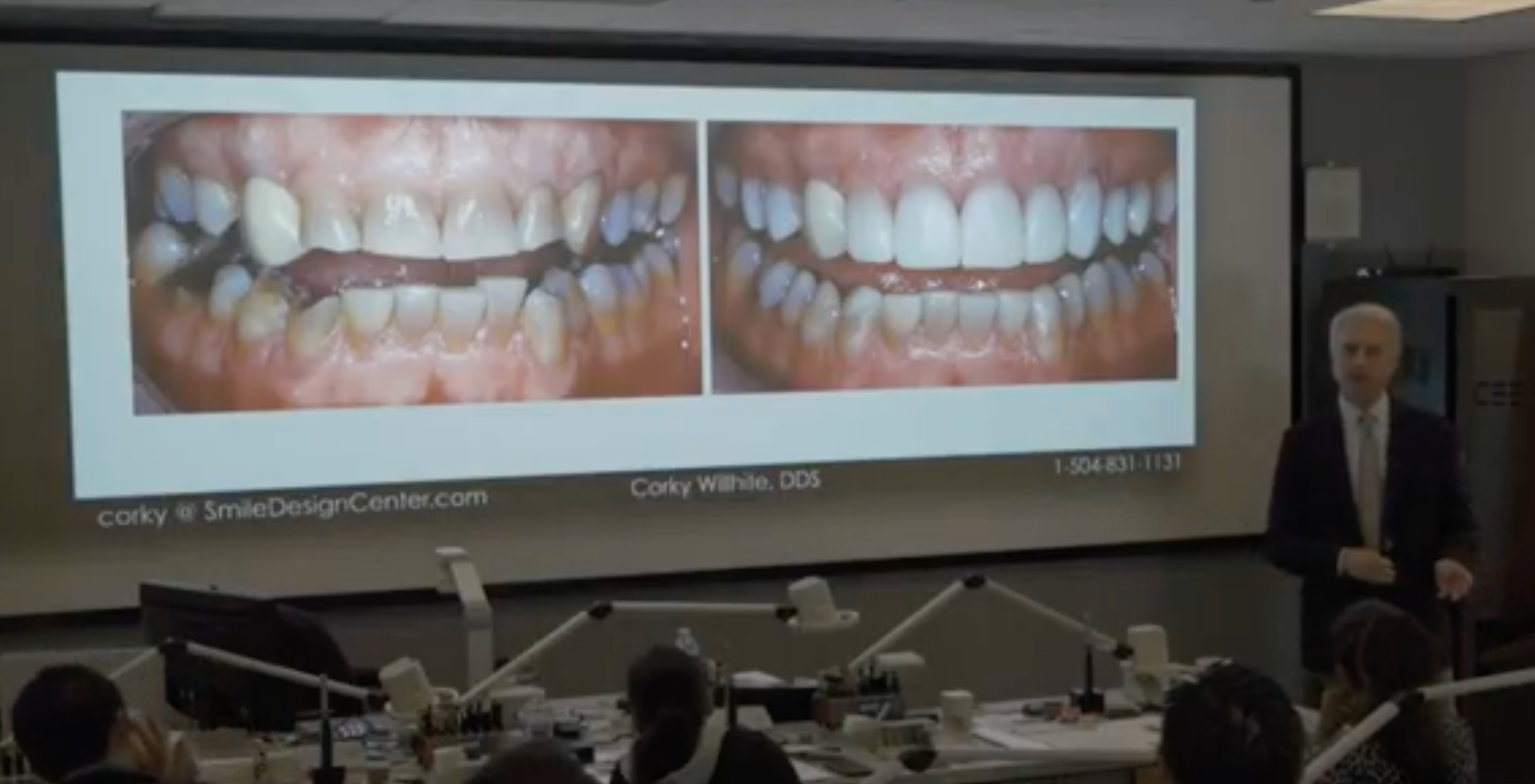The Ultimate Esthetics Course Anterior Composite Compositions