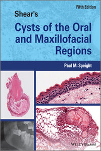 https://cdn.shopify.com/s/files/1/0735/1916/9749/files/Shears-Cysts-of-the-Oral-and-Maxillofacial-Regions-5th-Edition.jpg?v=1759509548