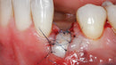 https://dental-books.com/wp-content/uploads/2022/08/Soft-Tissue-Management-around-Natural-Teeth-and-Dental-Implants.jpg
