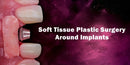 https://dentalmp4.com/wp-content/uploads/2023/05/Soft-Tissue-Plastic-Surgery-Around-Implants.jpg