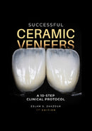 https://dentalmp4.com/wp-content/uploads/2024/07/Successful-Ceramic-Veneers.jpg