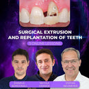 https://dental-books.com/wp-content/uploads/2023/12/Surgical-Extrusion-and-Replantation-of-Teeth.jpg