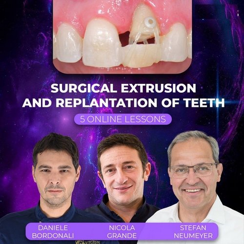Surgical Extrusion and Replantation of Teeth - Dentistry eBooks