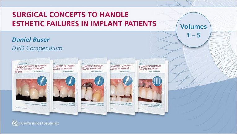 https://dentalmp4.com/wp-content/uploads/2022/07/Surgical-concepts-to-handle-esthetic-failures-in-implant-patients.jpg