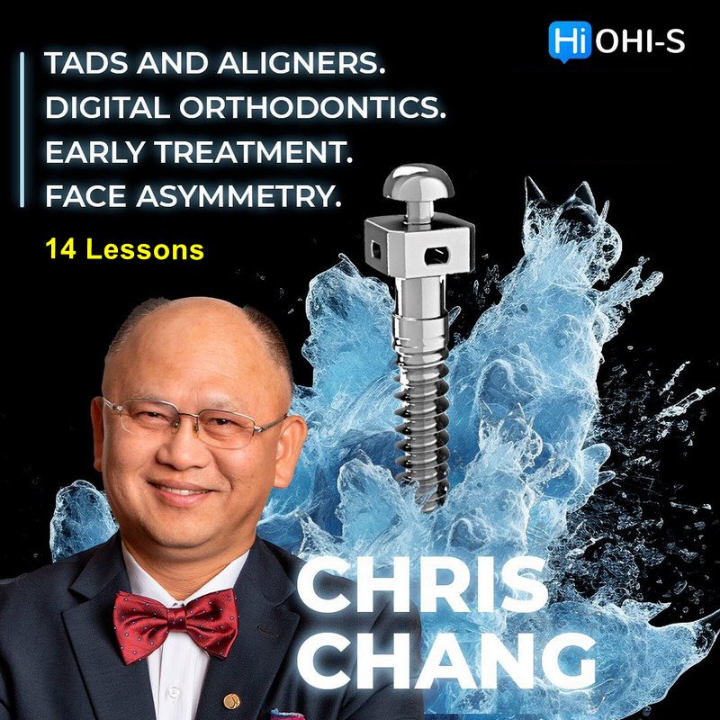 TADs and aligners, Digital orthodontics, Early treatment, Face asymmetry - Dentistry eBooks