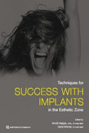 https://www.dentalbooks.org/wp-content/uploads/2019/10/Techniques-for-Success-With-Implants-in-the-Esthetic-Zone-180x270.jpg