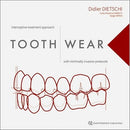 https://dentalmp4.com/wp-content/uploads/2023/08/Tooth-Wear-Interceptive-Treatment-Approach-with-Minimally-Invasive-Protocols.jpg
