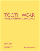 https://dentalmp4.com/wp-content/uploads/2023/01/Tooth-Wear-The-Quintessential-Challenge.jpg