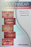 https://dental-library.net/wp-content/uploads/2019/01/Toothwear-The-ABC-of-the-Worn-Dentition.jpg