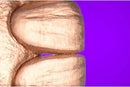 https://dentalmp4.com/wp-content/uploads/2022/06/Vertical-preparation-protocols-1.jpg