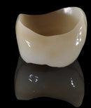 https://dentalmp4.com/wp-content/uploads/2022/06/Vertical-preparation-protocols-4.jpg