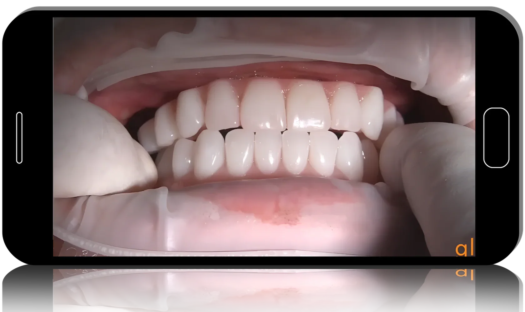 Online Residency Program A-Z in Implant Dentistry