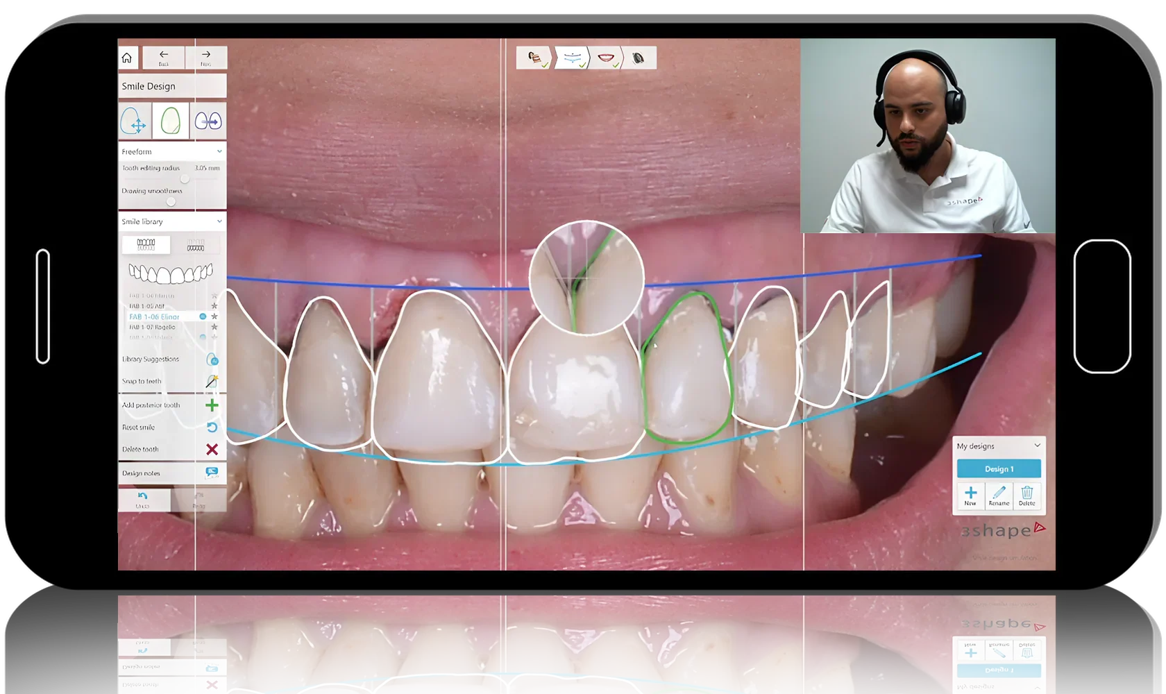 3Shape Practical Guide for Prosthodontists and Technicians