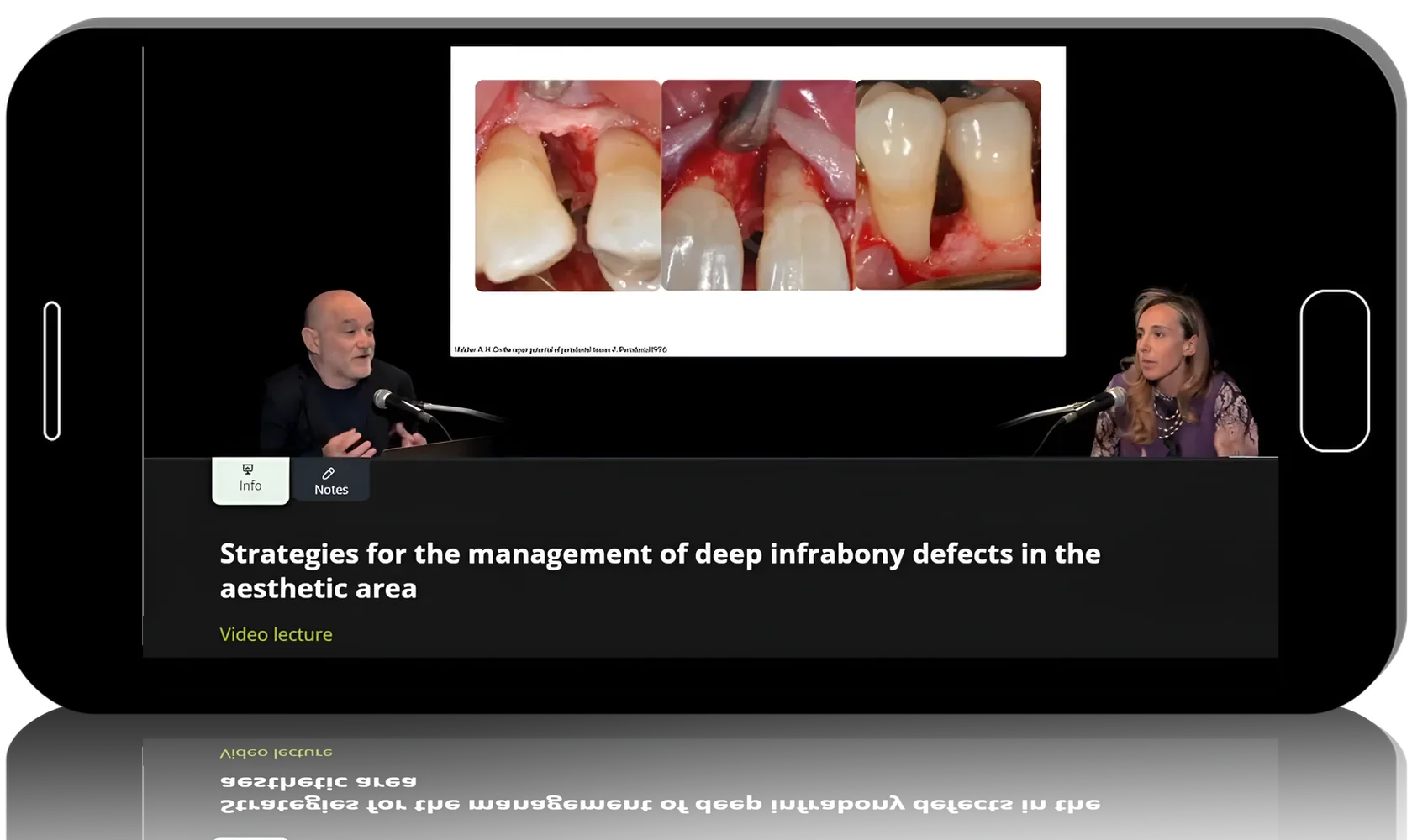 Papilla Preservation & Regeneration: Techniques for Infrabony Defects