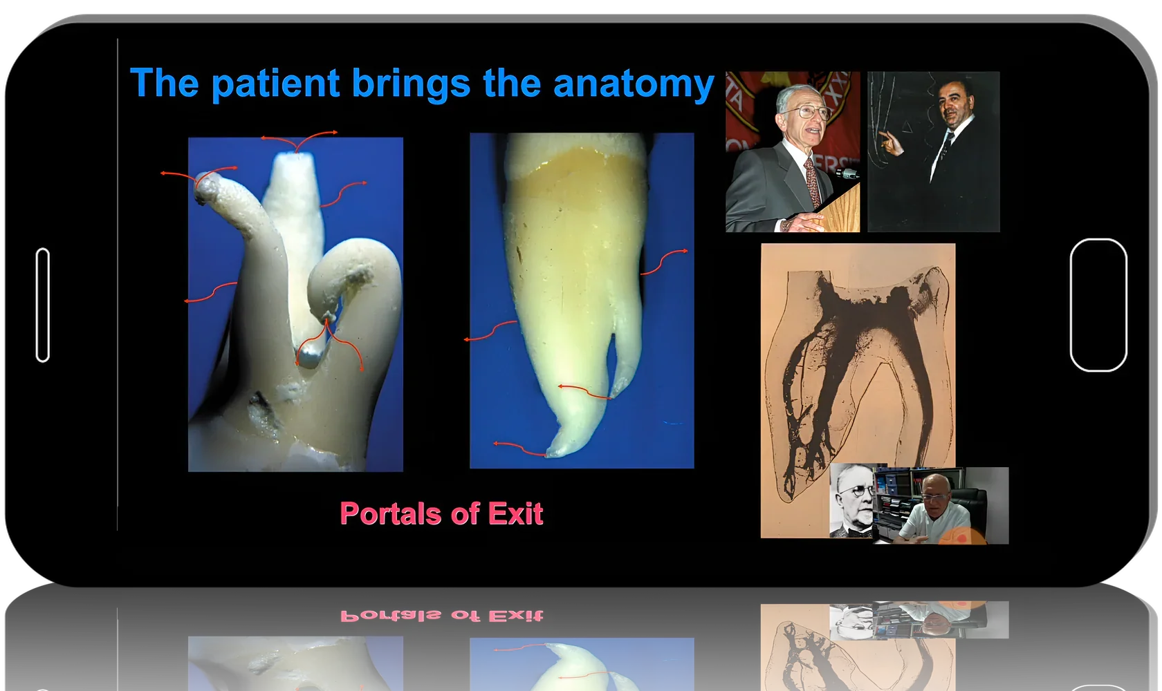 Working Length in Endodontics