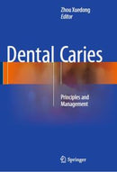 https://dental-library.net/wp-content/uploads/2019/01/dental-caries.jpg