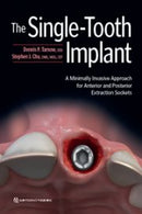 https://www.dentalbooks.org/wp-content/uploads/2019/11/he-Single-Tooth-Implant-180x270.jpg