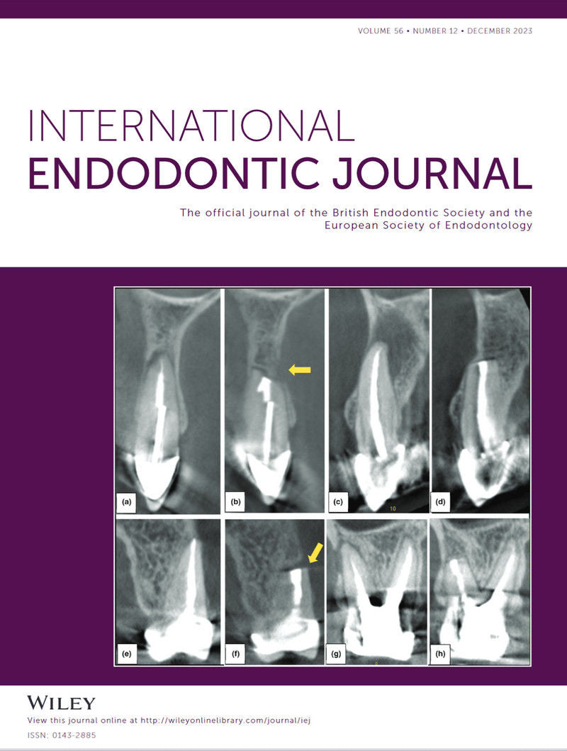 International Endodontic Journal, Full Archive (2008 – 2025)