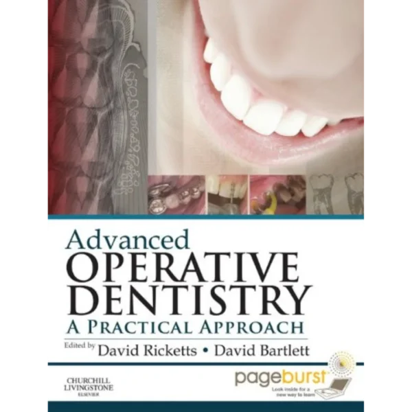 Advanced Operative Dentistry