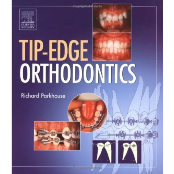 The Tip-Edge Orthodontic System